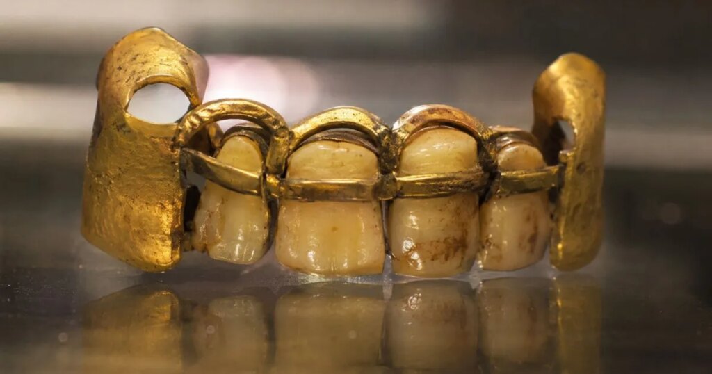 Las prótesis dentales más antiguas y sofisticadas conservadas de Europa tienen 2700 años y son etruscas