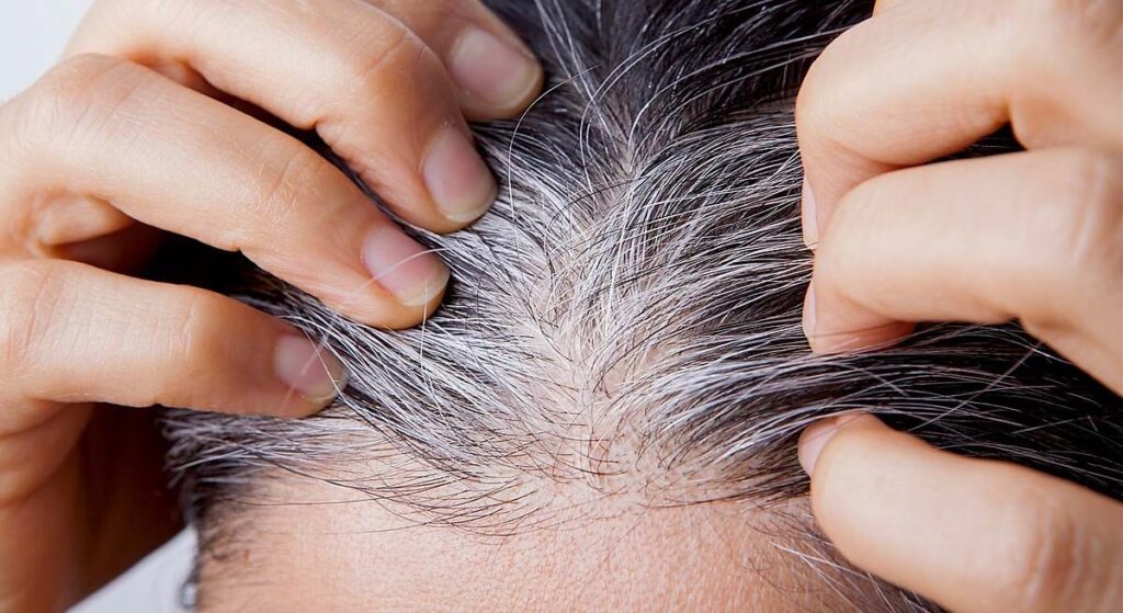 Los peluqueros no dan crédito: un estudio concluye que sería posible revertir la aparición de las canas