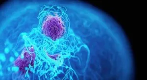 Los radiólogos coinciden: la resonancia multiparamétrica, clave para detectar el cáncer de próstata en sus fases iniciales