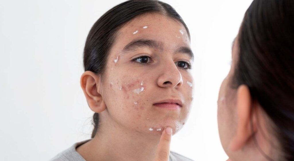 Un dermatólogo y una doctora coinciden en la importancia de detectar los casos en que un joven realmente tiene un problema de piel