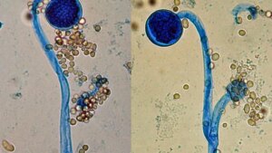 Un hongo del suelo puede convertirse en patógeno humano con solo cambiar de forma. Dos genes funcionan como interruptores de una infección potencialmente letal