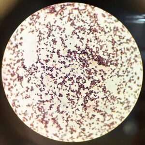 Bioplásticos más sostenibles y económicos gracias a una bacteria modificada