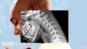 «Cuerpo de teléfono»: cómo la tecnología nos arruga el cuello y debilita las manos