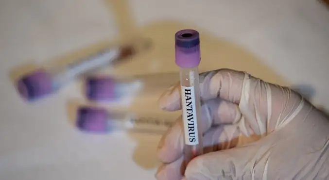 Federación Médica pide actuación ante casos de hantavirus en Anzoátegui y muertes de médicos en Barinas