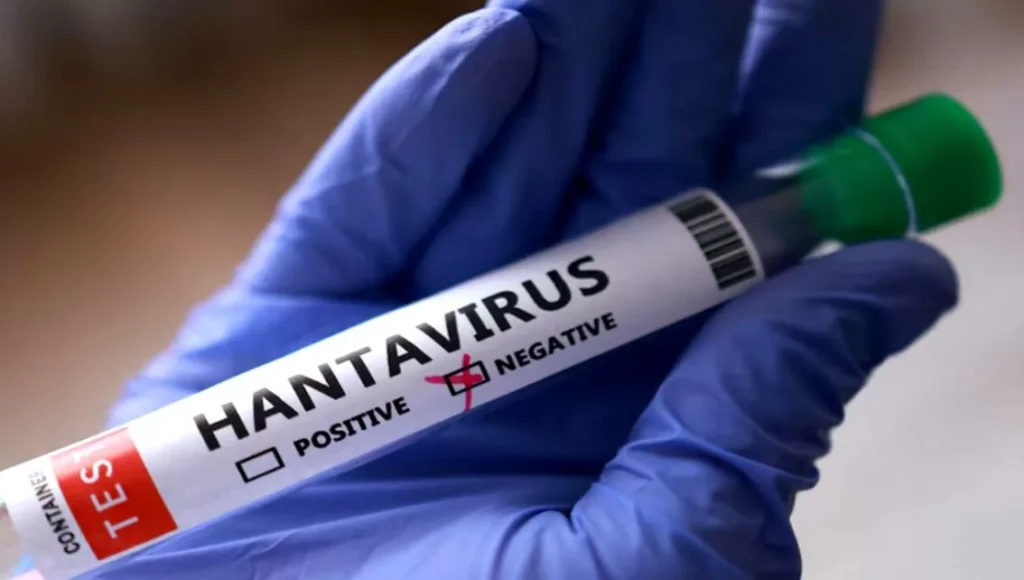 Ministerio de Salud confirma fallecimiento de tres personas por Hantavirus en Anzoátegui y dos médicos en Barinas